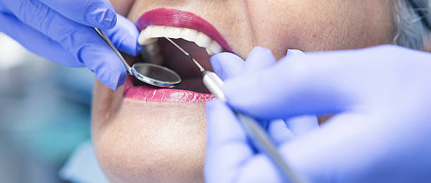 Best Knocked-Out Tooth (Avulsed Tooth) Treatment in Oak Leaf, TX